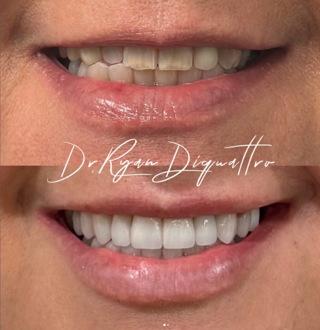 Smile makeover before and after — Scottsdale