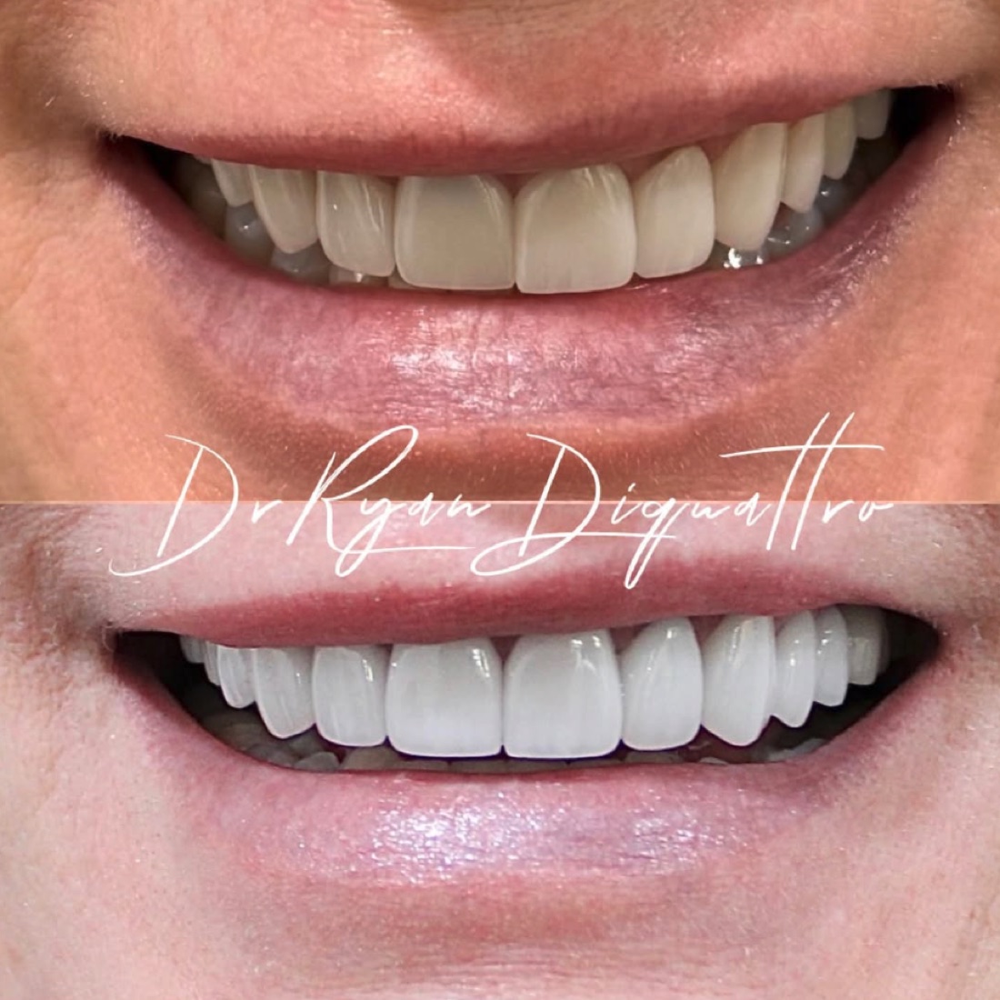 Cosmetic dentistry smile transformation