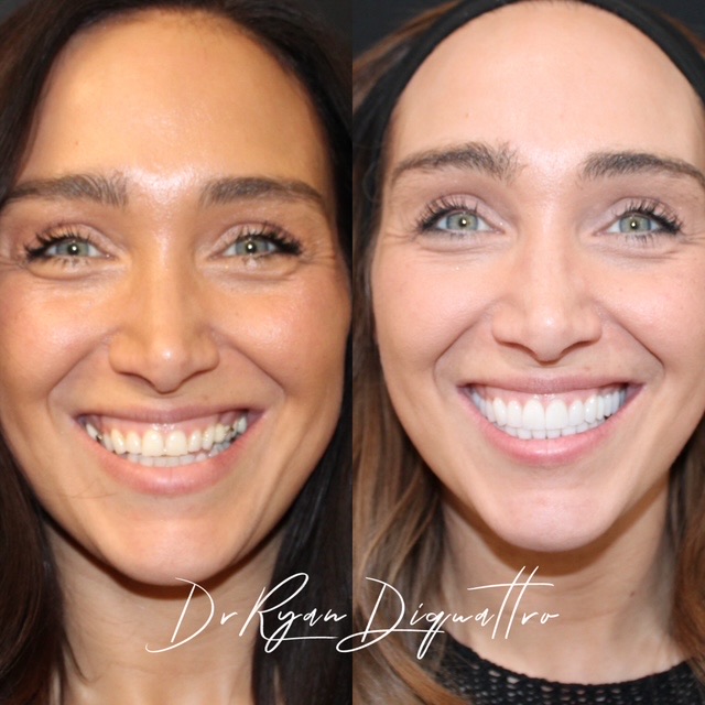 Cosmetic dentistry before and after — Scottsdale