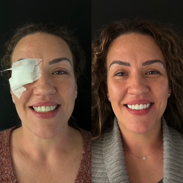 Before and After Image: Smile Makeover - front